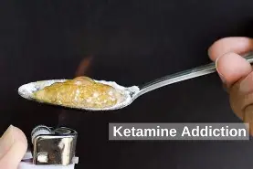 Ketamine Detox Explained: A Step by Step Overview